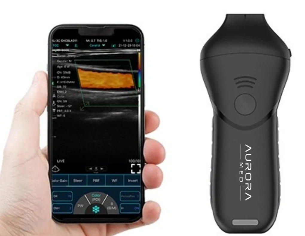 Aparelho da linha Derma conectado a um celular exibindo imagem de ultrassom com Doppler colorido no app MYUSG.